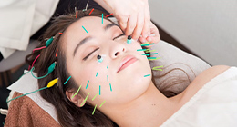 ナチュラル美容鍼コース